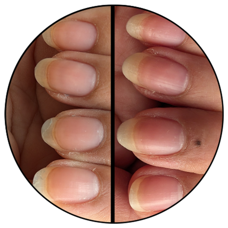 Advanced Nail Strengthener - Image 2